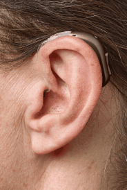 Contours d'oreille (BTE) :